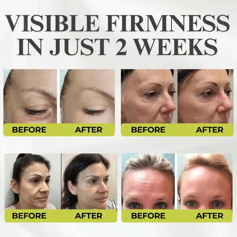 👏🌿Proudly Made in the USA💫Tiworld® Advanced Peptide Botox-Style + Vita-A Retinol Lifting Renewal Cream – Today Only 49% OFF