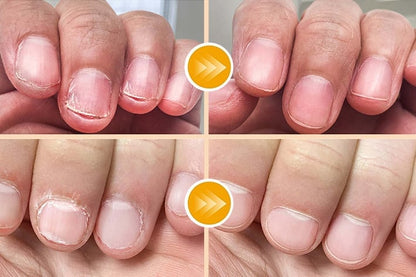 The Safest Electric Nail Clipper for Babies, Adults & Seniors